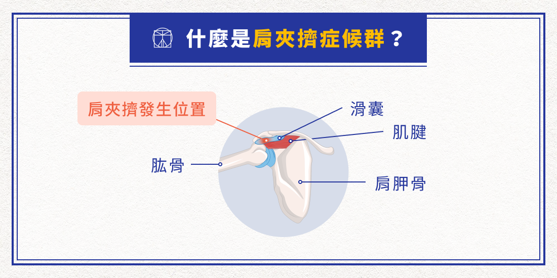 什麼是肩夾擠症候群？